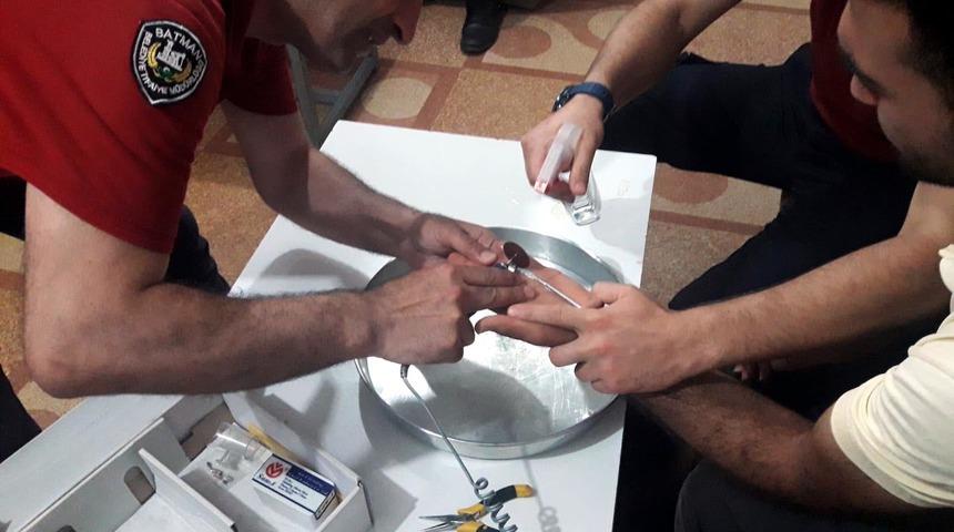 Parmağı sıkıştıran y&uuml;z&uuml;ğ&uuml; itfaiye &ccedil;ıkardı