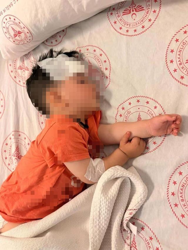 Sokak k&ouml;peklerinin saldırdığı 1 bu&ccedil;uk yaşındaki &ccedil;ocuk yaralandı 1