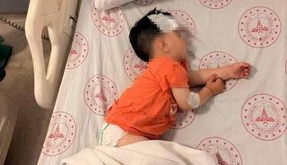 Sokak k&ouml;peklerinin saldırdığı 1 bu&ccedil;uk yaşındaki &ccedil;ocuk yaralandı