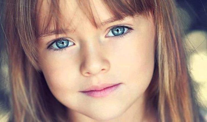 Iste Dunyanin En Guzel Cocugunun Son Hali Yasam Haberleri