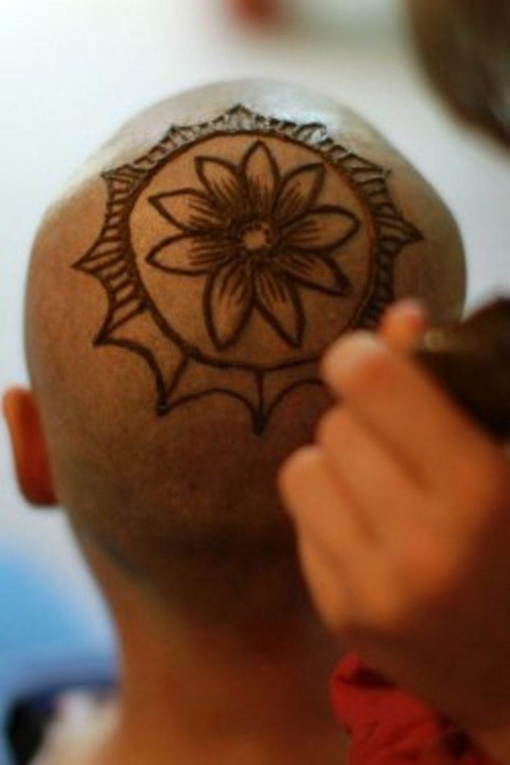 Kaybettiği saçlarının yerine bakın ne yaptırdı  G5