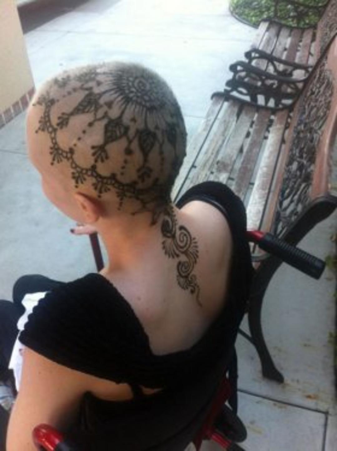 Kaybettiği sa&ccedil;larının yerine bakın ne yaptırdı 