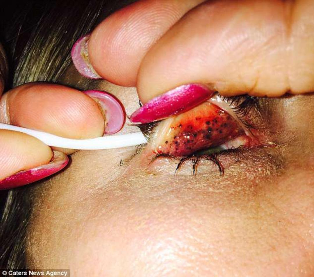 Korkun&ccedil; fotoğraflar, rimelinizi d&uuml;zg&uuml;n bir şekilde &ccedil;ıkarmazsanız neler olacağını g&ouml;zler &ouml;n&uuml;ne seriyor