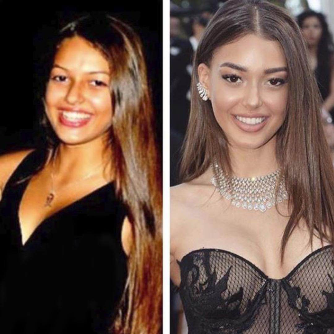 İşte Dilan Çiçek Deniz'in eski görünümü...