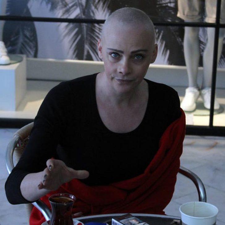 Oyuncu Dilek Serbest'in saçlarına ne oldu? G1