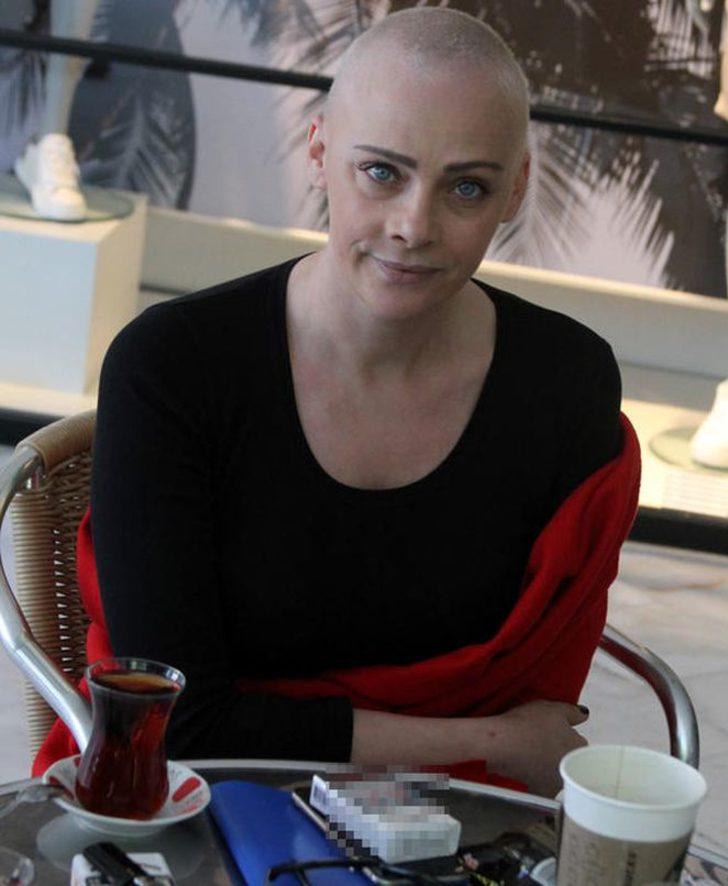 Oyuncu Dilek Serbest'in saçlarına ne oldu? G2