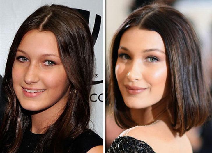 Bella Hadid'ten estetik açıklaması  G1