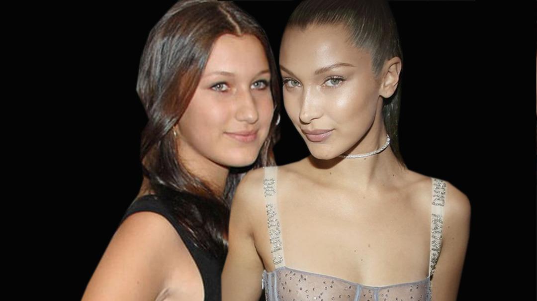 Bella Hadid'ten estetik a&ccedil;ıklaması 