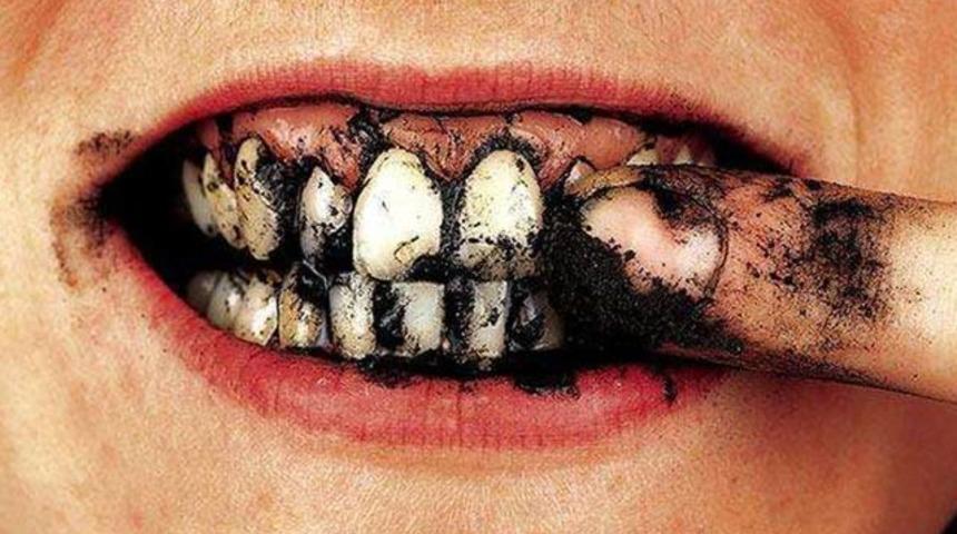 G&uuml;l&uuml;ş&uuml;n&uuml;z parlasın! Sigara ve kahve lekelerini yok eden doğal karışım