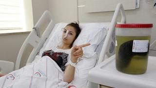 Antalya'da mide ağrısı nedeniyle hastaneye gitti! Karnından 1.5 kilo saç çıktı!