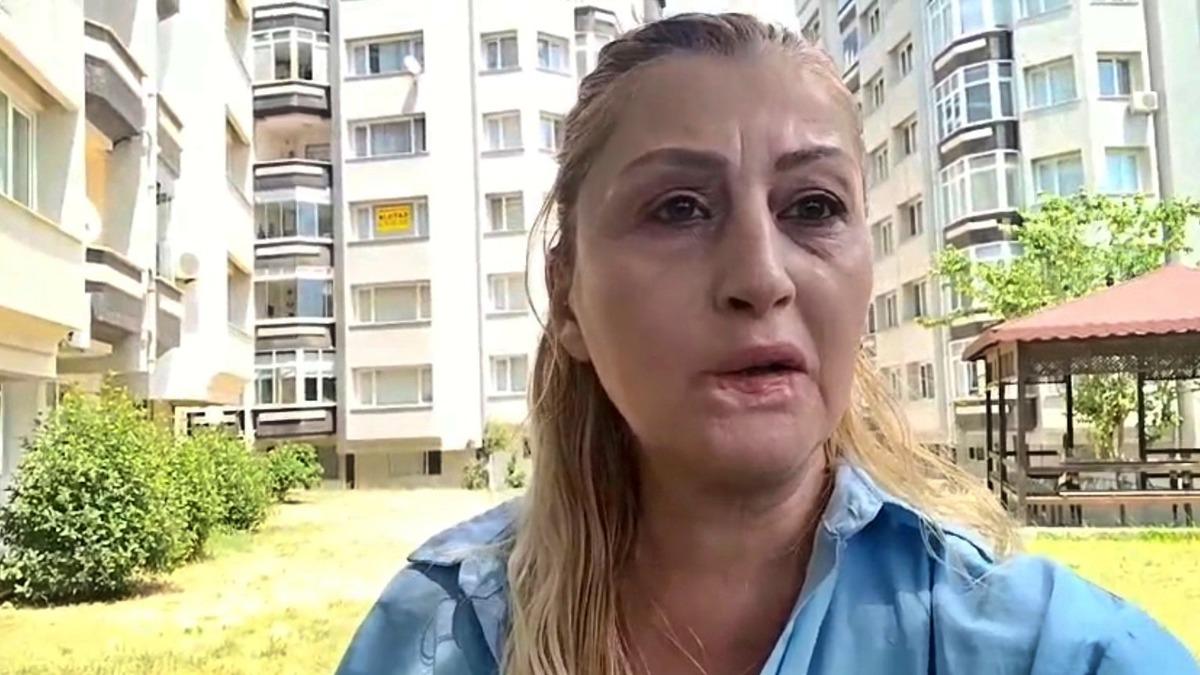 Göbeğinden alıp yüzüne enjekte ettiler: Dudağını çürüttü! 5