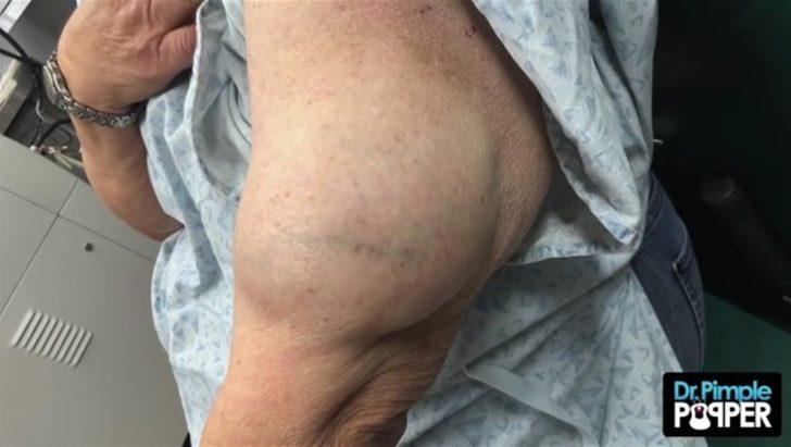 Kolundan çıkanlar şoke etti  G2