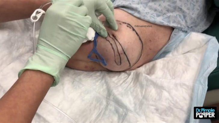 Kolundan çıkanlar şoke etti  G3