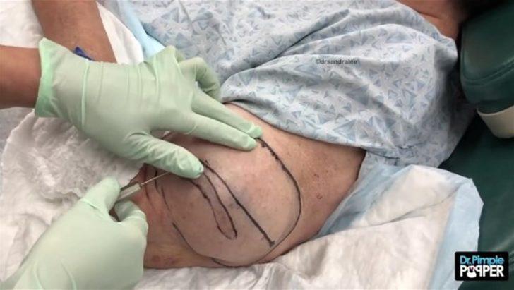 Kolundan çıkanlar şoke etti  G4