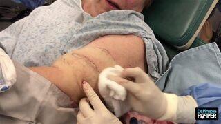 Kolundan çıkanlar şoke etti 