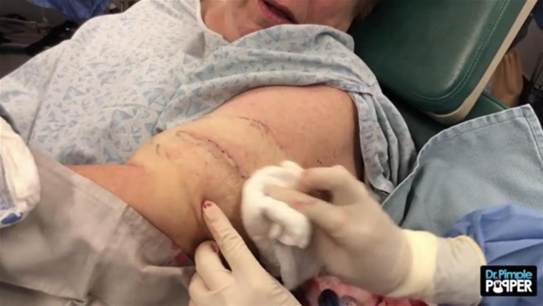 Kolundan &ccedil;ıkanlar şoke etti 