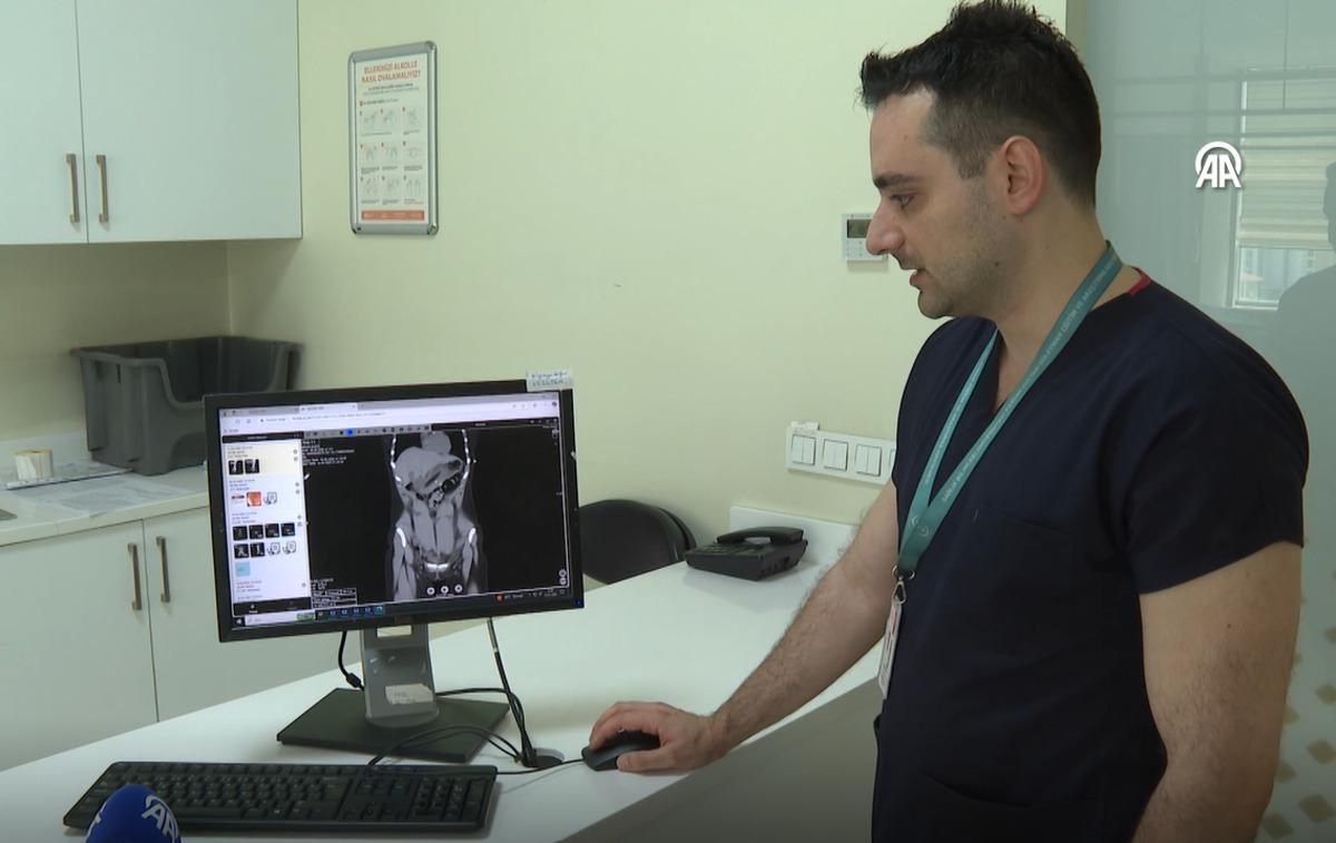 Doktorlar inanamadı: Zayıflamak isterken diş fır&ccedil;ası yuttu 3