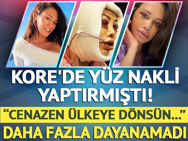 Kore'de y&uuml;z nakli yaptırmıştı! 'Cenazen &uuml;lkeye d&ouml;ns&uuml;n' yorumlarına dayanamadı