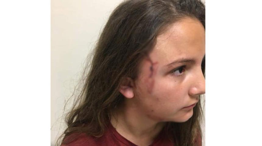 Çocuk parkında dehşet anları!