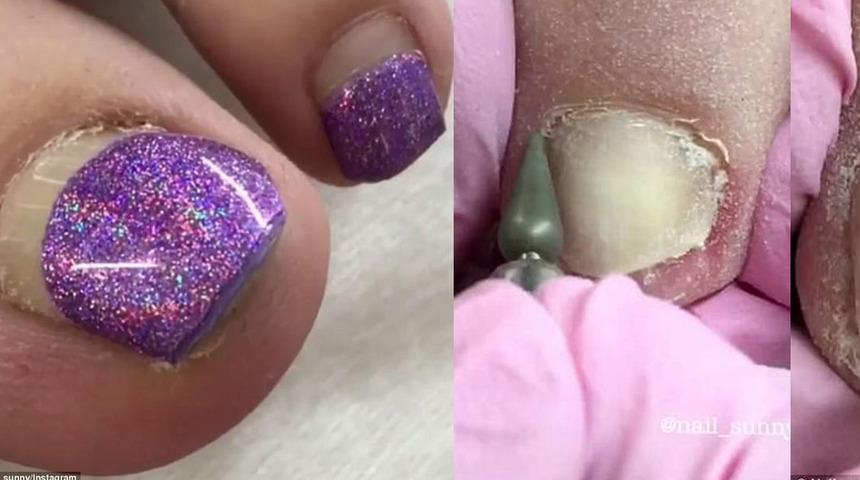 Tırnak d&ouml;n&uuml;ş&uuml;m&uuml; viral oldu, 350 bin kişi bu anı izledi