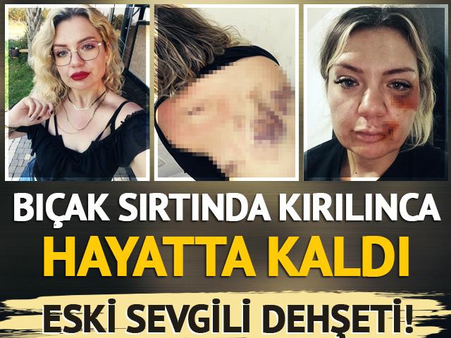 Kırılan bı&ccedil;akla hayatta kaldı! Antalya'da eski sevgili dehşeti
