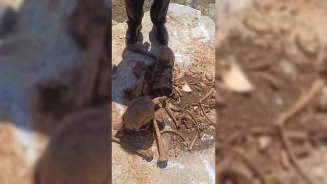 Malatya da inşaat kazısında insan kemikleri bulundu 2