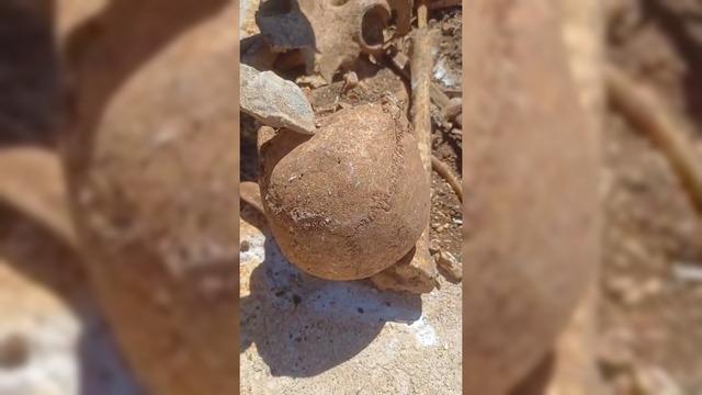Malatya da inşaat kazısında insan kemikleri bulundu 1