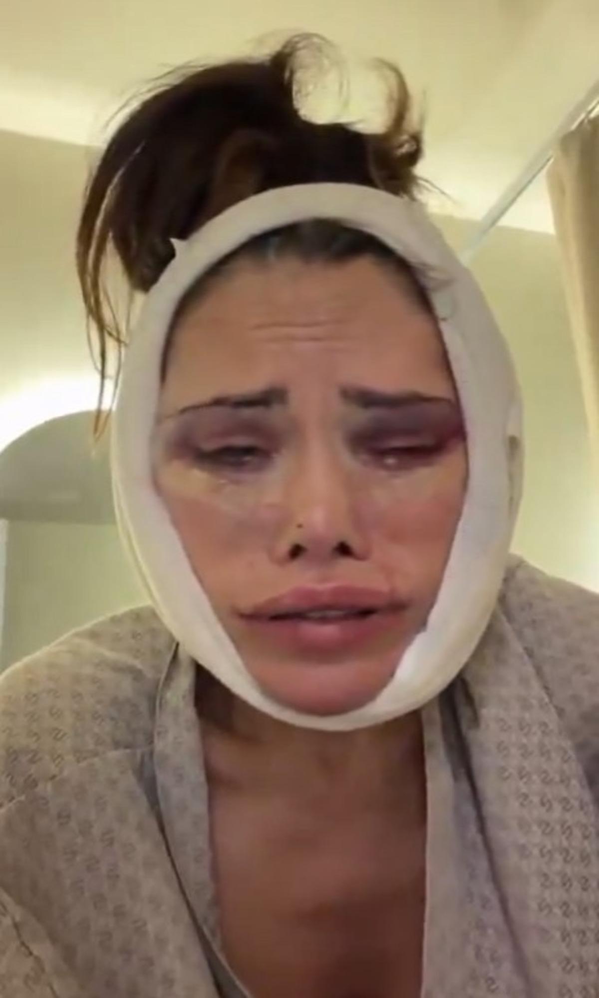 Kore de y&uuml;z nakli yaptırmıştı! Didem Ceran bir kez daha bı&ccedil;ak altına yattı! Son haline kimse dayanamadı  4