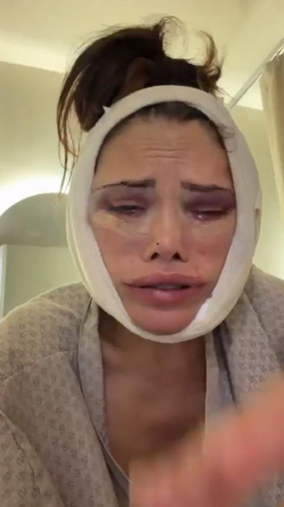 Kore de y&uuml;z nakli yaptırmıştı! Didem Ceran bir kez daha bı&ccedil;ak altına yattı! Son haline kimse dayanamadı  3