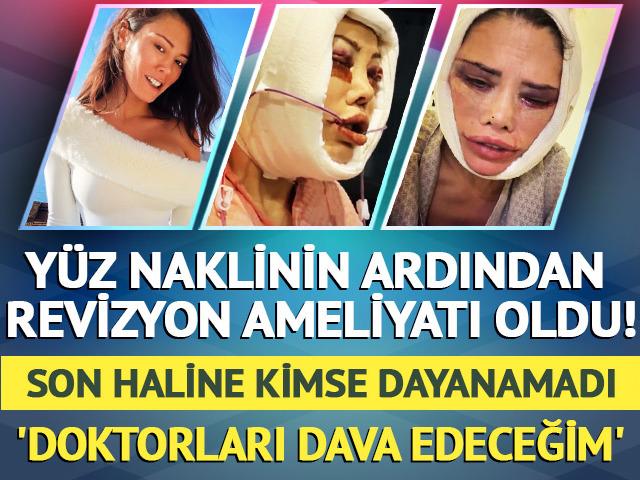 Bir kez daha bı&ccedil;ak altına yattı! Son haline kimse dayanamadı 