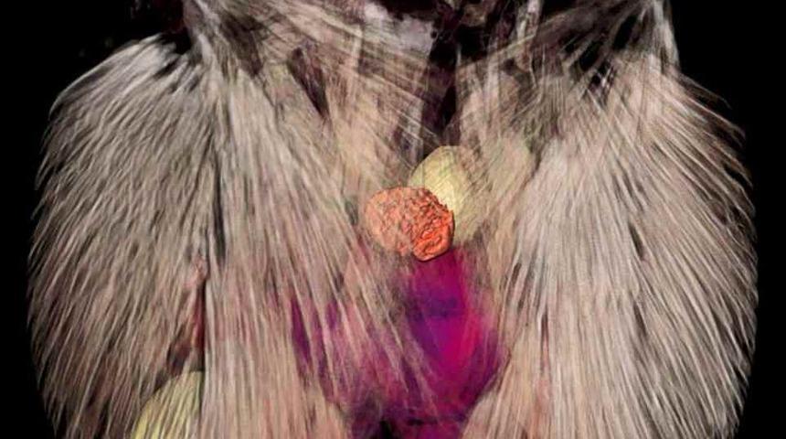 Zombi yapan parazit korkuttu! Her yerde olabilir!!!