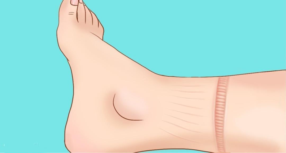 V&uuml;cudunuzdan gelen bu sinyalleri dikkate alın! Kalp krizi ge&ccedil;iriyor olabilirsiniz