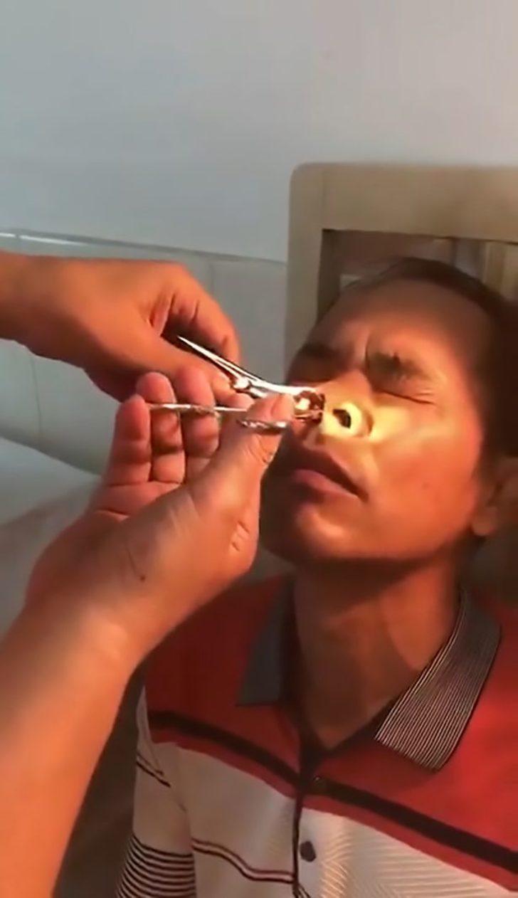 Bu görüntüleri mideniz kaldırmayabilir!  G3