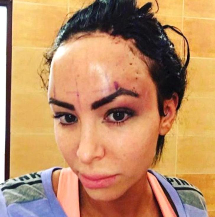 11 yılda 28 kez ameliyat oldu! Barbie bebeğe benzemek isterken bakın ne hale geldi G4