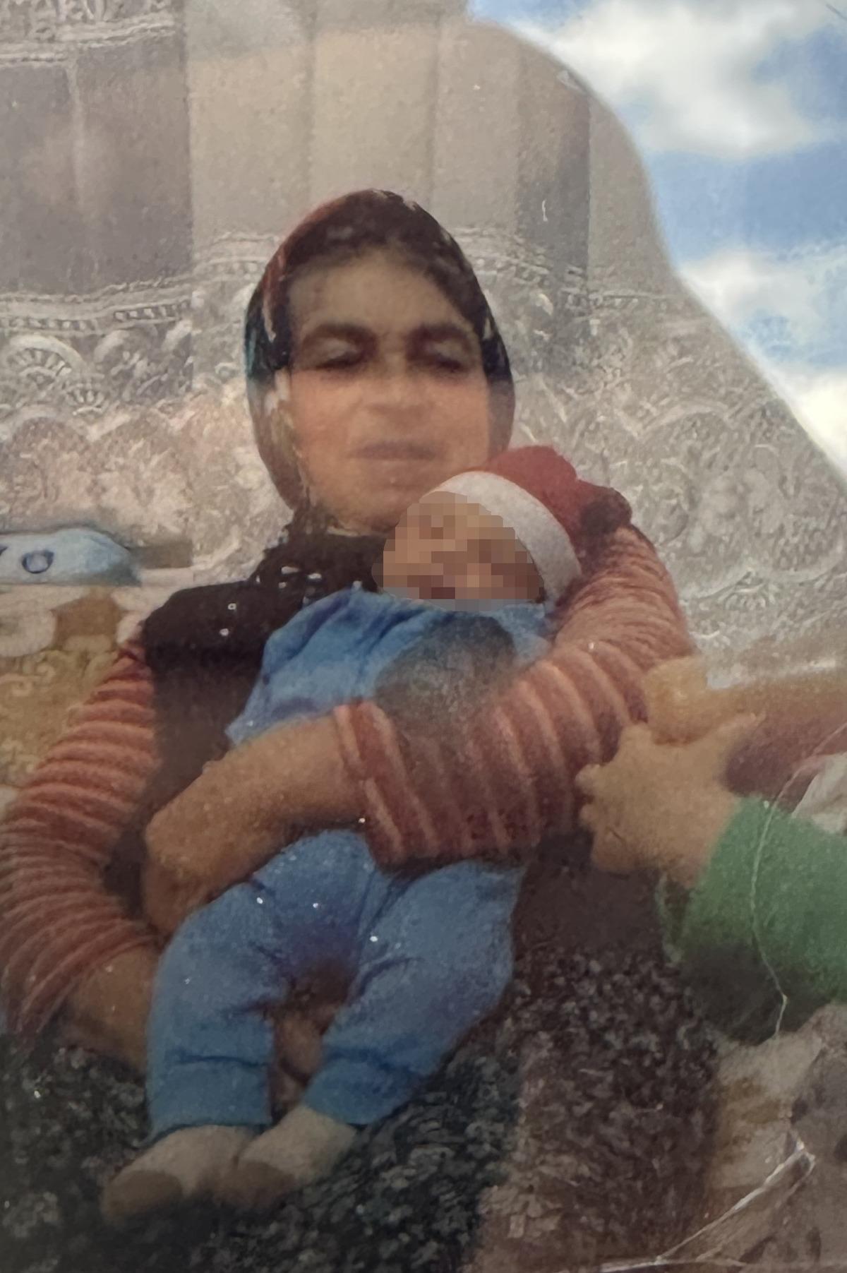 Bir ısırıkla başı d&ouml;nd&uuml;, iştahtan kesildi... 15 g&uuml;n sonra hayatını kaybetti 1