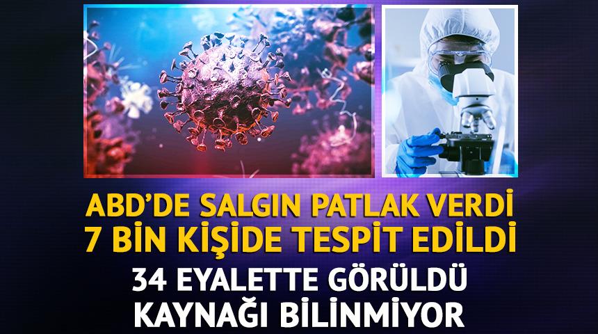 7 bin kişi bu hastalığa yakalandı! 34 eyalette vakalar var: Salgının kaynağı bilinmiyor