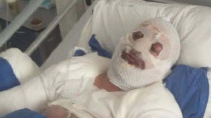 Saç kurutma makinesi bu hale getirdi!