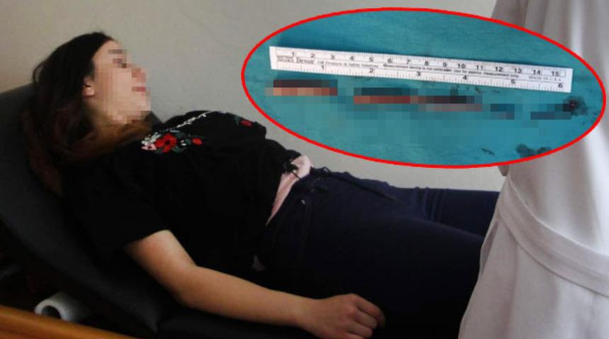 Gen&ccedil; kızın kal&ccedil;asından kurşun kalem &ccedil;ıktı! Doktorlar şoke oldu