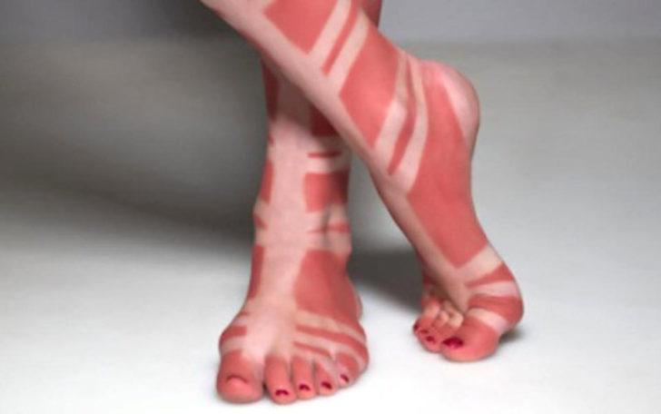 Giydiğine bin pişman oldu! Güneşte saatler o bikiniyle oturunca... G5