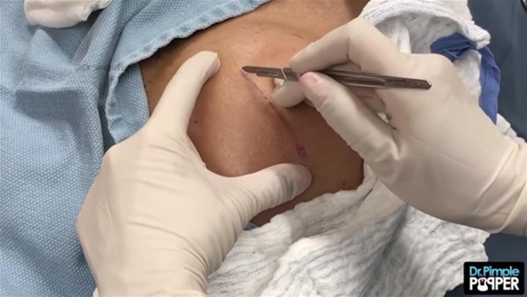 Sırtında yağ kaps&uuml;l&uuml; &ccedil;ıkınca... 