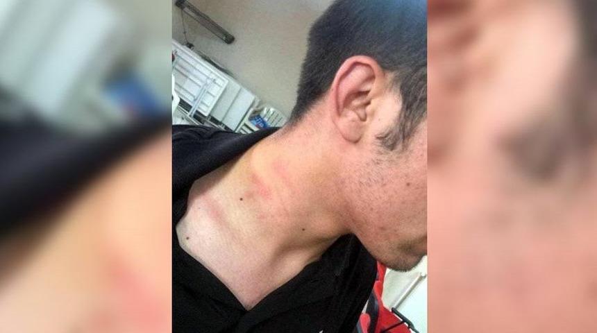 AK Parti'li vekil tartıştığı CHP'li gencin boğazını sıktı, daha sonra özür diledi