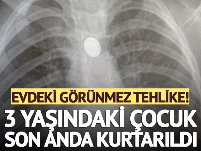 Evdeki g&ouml;r&uuml;nmez tehlike! 3 yaşındaki &ccedil;ocuk son anda kurtarıldı