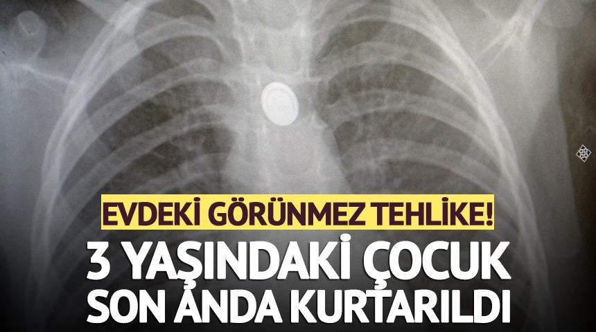 Evdeki g&ouml;r&uuml;nmez tehlike! 3 yaşındaki &ccedil;ocuk son anda kurtarıldı