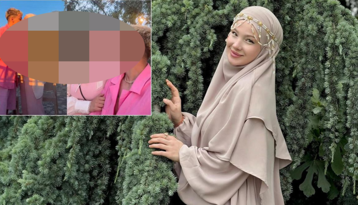 &Ouml;p&uuml;şme g&ouml;r&uuml;nt&uuml;leri yayıldı! O g&ouml;r&uuml;nt&uuml;ler ger&ccedil;ek mi?