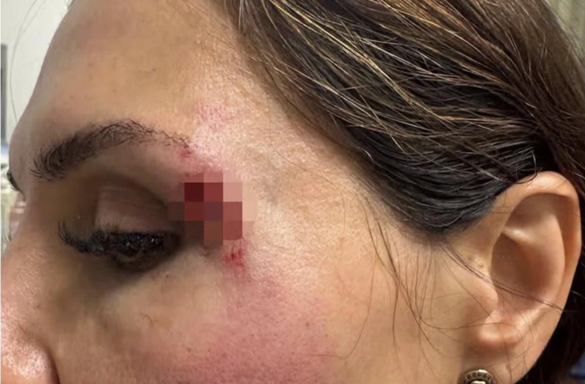 Sosyal medya katil pantolonu konuşuyor! Giyen ya dizini kırıyor ya da yüzünü parçalıyor 3