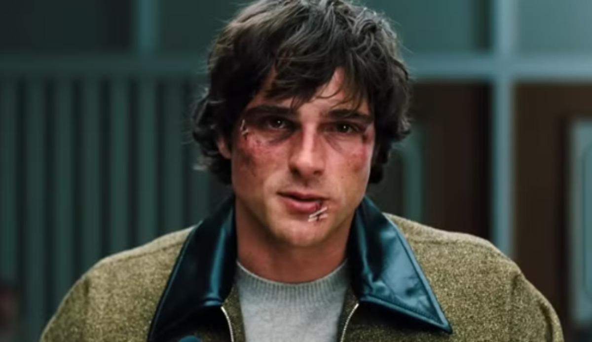 Jacob Elordi iki topuğunu birden kırdığını açıkladı 2