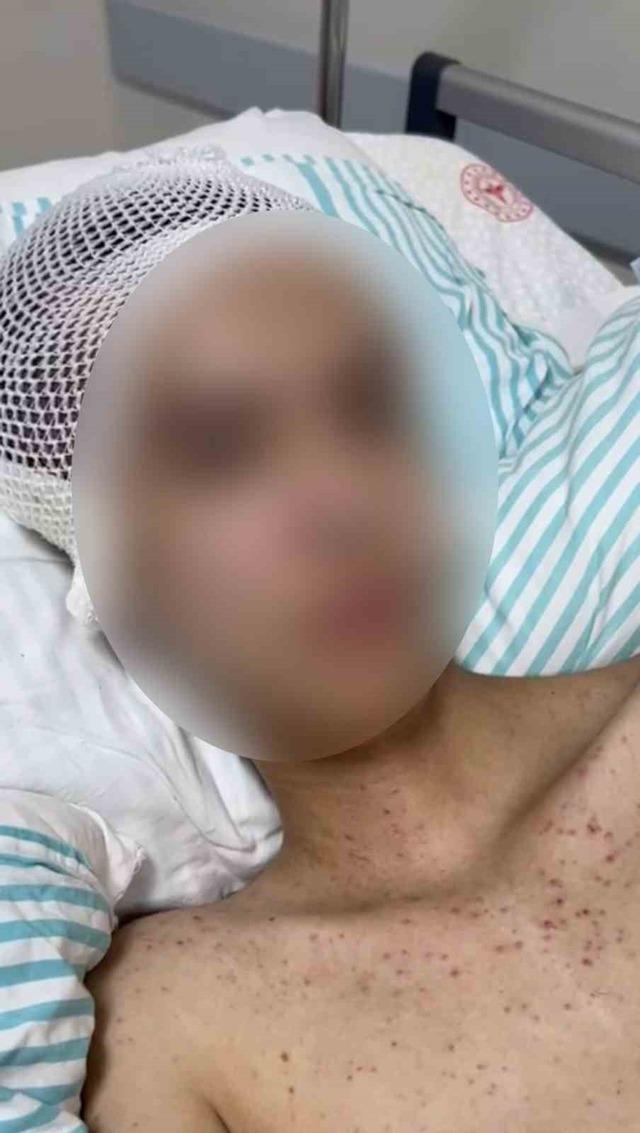 Tacize direndiği iddiasıyla başından vurulan çocuk felç kaldı 2