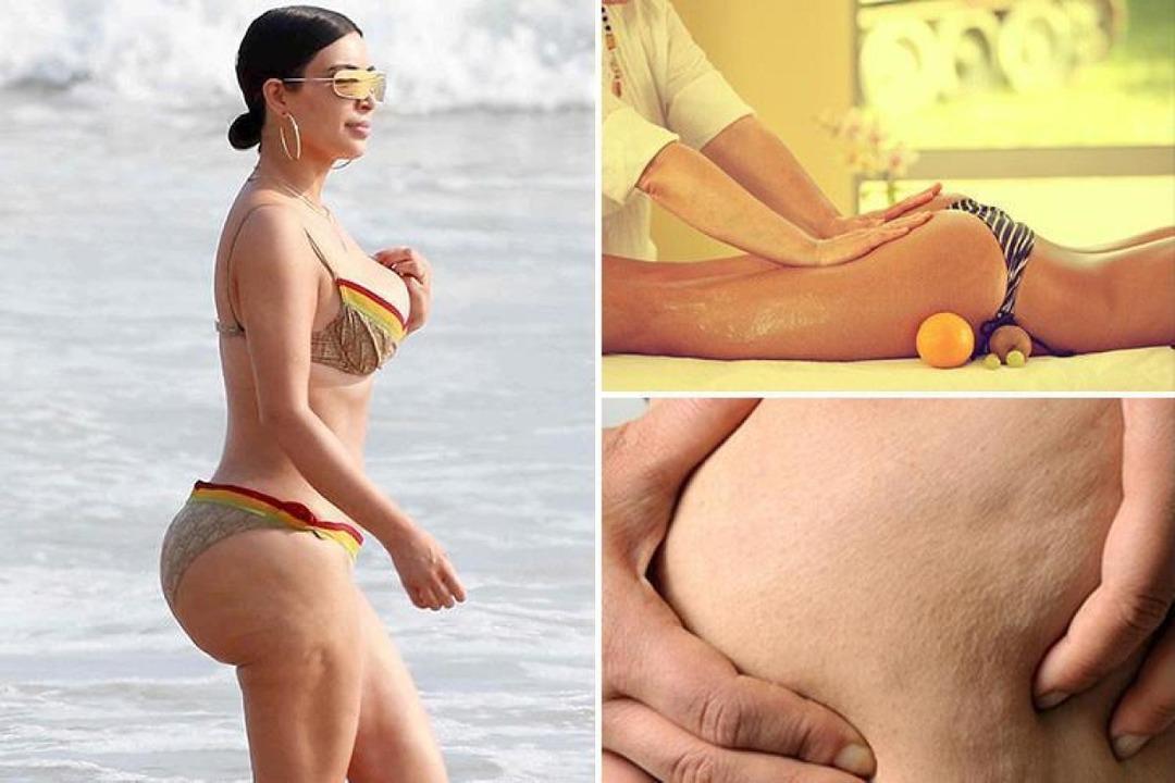 Yalnız değilsiniz ve utanılacak bir şey yok! Sel&uuml;lit her kadının derdi