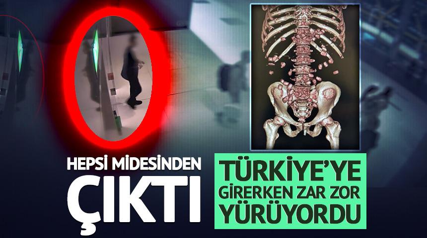 Midesinden çıkanları duyunca inanamayacaksınız