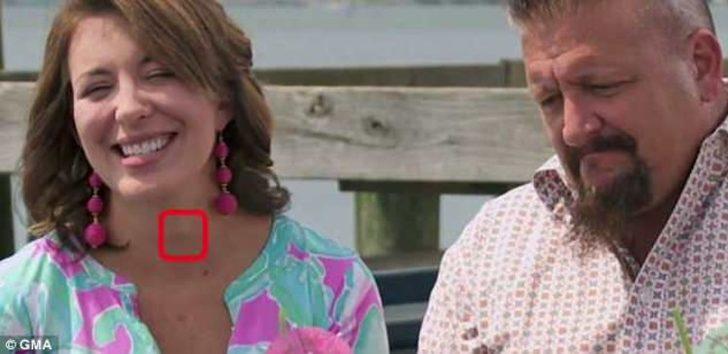 Doktor televizyondaki kadını görünce hemen telefona sarıldı! G1